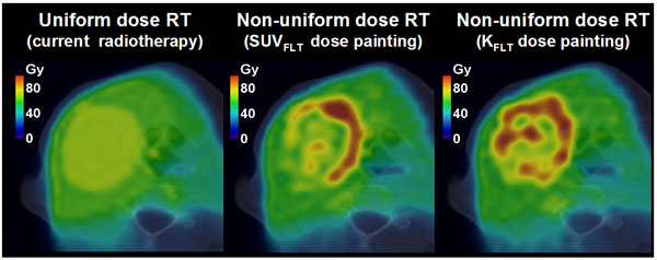 Attacking Tumors Bit by Bit