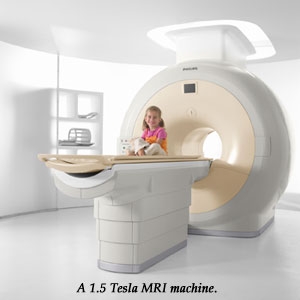 A 1.5 Tesla MRI machine.